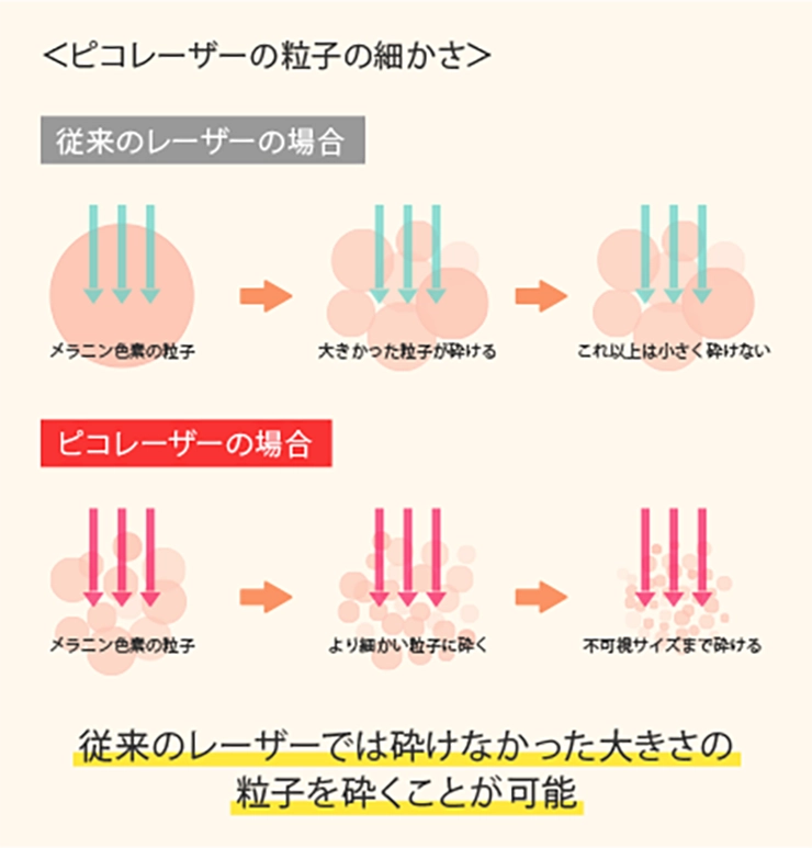 ピコレーザーの粒子の細かさ